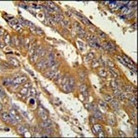PAN3 Rabbit Polyclonal Antibody