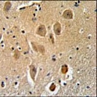 MICALL2 Rabbit Polyclonal Antibody