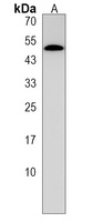 PRAK (Phospho-S93) Rabbit Polyclonal Antibody