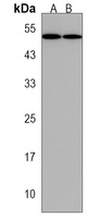 ZMPSTE24 Rabbit Polyclonal Antibody