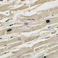 Collagen 14 alpha 1 Rabbit Polyclonal Antibody
