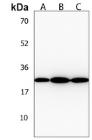 BCL2L10 Rabbit Polyclonal Antibody