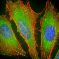 BCL2L10 Rabbit Polyclonal Antibody
