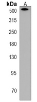 Plectin Rabbit Polyclonal Antibody