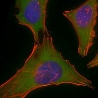 Plectin Rabbit Polyclonal Antibody