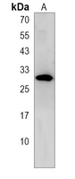 MVB12A Rabbit Polyclonal Antibody
