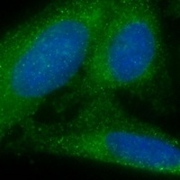 MVB12A Rabbit Polyclonal Antibody