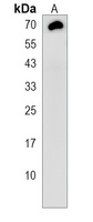 TMEM106B Rabbit Polyclonal Antibody
