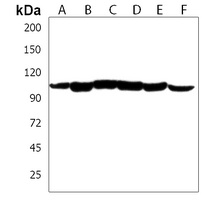 PGAP1 Rabbit Polyclonal Antibody