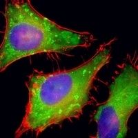 PGAP1 Rabbit Polyclonal Antibody