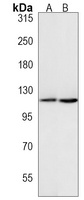 NOP2 Rabbit Polyclonal Antibody