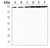 TAF4 Rabbit Polyclonal Antibody