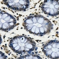 TAF4 Rabbit Polyclonal Antibody