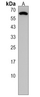 CSRNP1 Rabbit Polyclonal Antibody