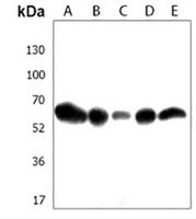 RSL1D1 Rabbit Polyclonal Antibody