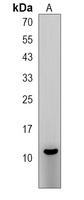 RIG Rabbit Polyclonal Antibody