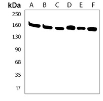 PDS5B Rabbit Polyclonal Antibody