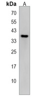 CXXC5 Rabbit Polyclonal Antibody