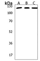 STARD8 Rabbit Polyclonal Antibody