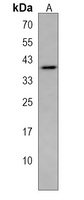 EI24 Rabbit Polyclonal Antibody