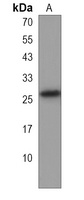 BBC3 Rabbit Polyclonal Antibody