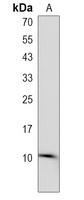 ATP5EP2 Rabbit Polyclonal Antibody