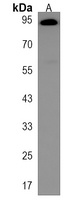 VAC14 Rabbit Polyclonal Antibody