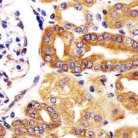 VAC14 Rabbit Polyclonal Antibody