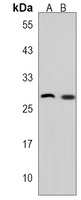 CELA2B Rabbit Polyclonal Antibody