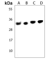 VDAC2 Rabbit Polyclonal Antibody