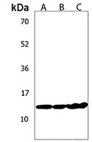 MTCP1 Rabbit Polyclonal Antibody
