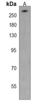TPR Rabbit Polyclonal Antibody