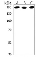 IQSEC2 Rabbit Polyclonal Antibody