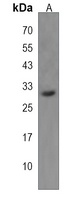 FBXO45 Rabbit Polyclonal Antibody