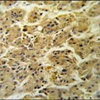 NDUFS2 Rabbit Polyclonal Antibody
