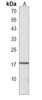 LYPD1 Rabbit Polyclonal Antibody