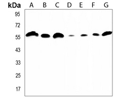 Artemis Rabbit Polyclonal Antibody