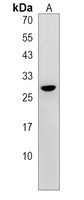 NUCKS1 Rabbit Polyclonal Antibody