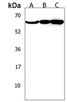 TCHP Rabbit Polyclonal Antibody