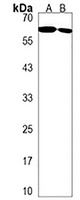 ENTPD2 Rabbit Polyclonal Antibody
