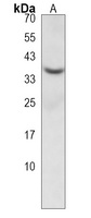 CRELD2 Rabbit Polyclonal Antibody