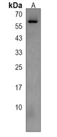 CDC73 Rabbit Polyclonal Antibody
