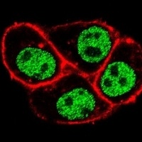 CDC73 Rabbit Polyclonal Antibody