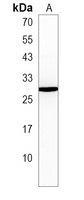 CCDC85B Rabbit Polyclonal Antibody