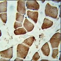 CCDC85B Rabbit Polyclonal Antibody