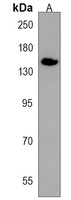 NUP153 Rabbit Polyclonal Antibody