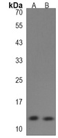 SPRR1B Rabbit Polyclonal Antibody