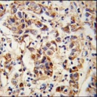 SPRR1B Rabbit Polyclonal Antibody