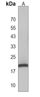DLK2 Rabbit Polyclonal Antibody