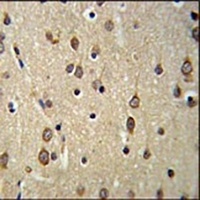 DLK2 Rabbit Polyclonal Antibody